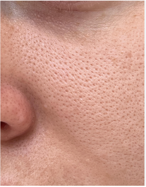 Virtual Skincare Consultation: Personalized Skin Care Advice From Anywhere
